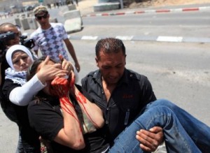 Amidst Furor Over Gaza, Israel Shoots Out the Eye of Protester